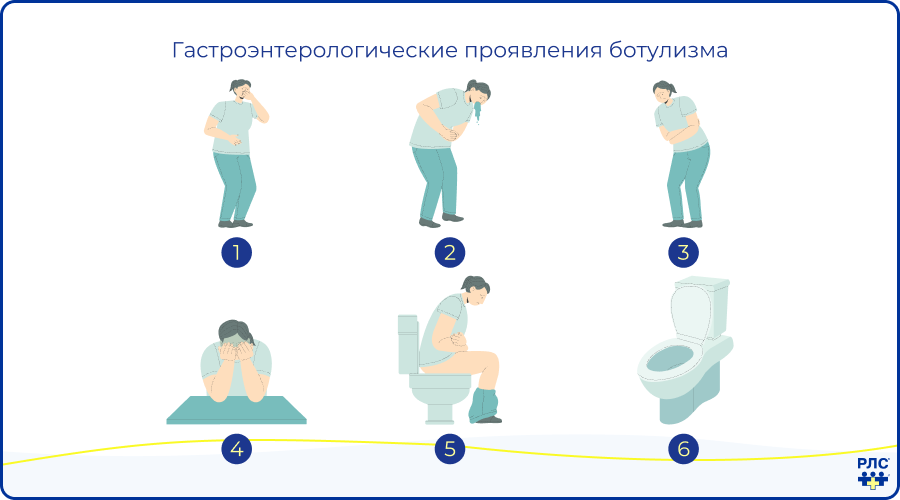 Гастроэнтологические проявления ботулизма